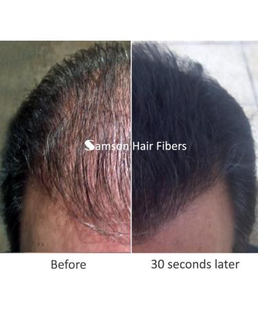 Refill kit Hair Fiber By Samson XLarge 50 Grams Hide Hair Loss and Hair Transplant Natural Looking Results Made in USA Hair Loss Concealer (Dark Brown) - Buy Online on GoSupps.com