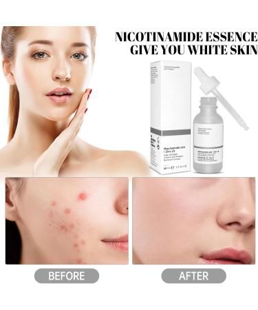 Niacinamide Facial Moisturizing Essence 10% Niacinamide + 1% Zinc Anti Aging & Wrinkle Face Serum softens and moisturizes skin evens skin tone suitable for all skin types -(30ML) - Buy Online on GoSupps.com