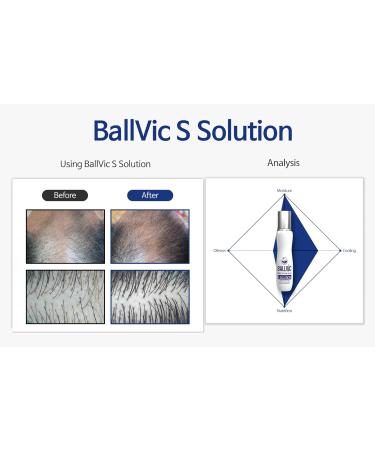 BallVic S Solution - Scalp Care Hair Loss Treatment for Men - DHT Blocker Tonic Serum - 1.8 Oz (50g) - Buy Online on GoSupps.com