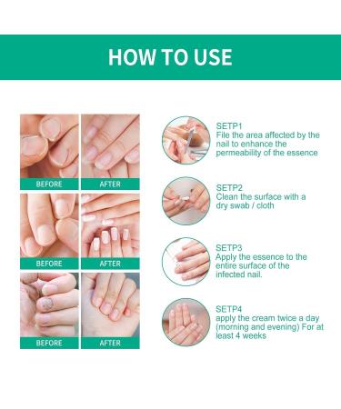 3-Pack Kerassentials Toenail Treatment Oil - Extra Strength Nail Repair Solution - Buy Online on GoSupps.com