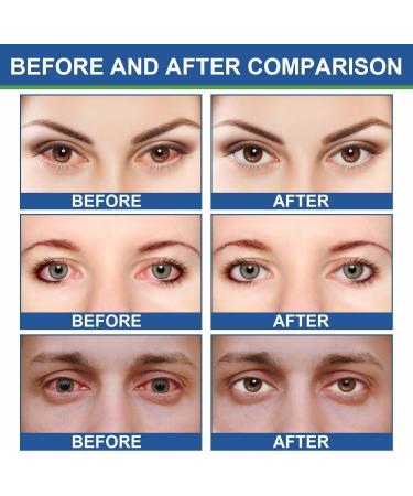 EXQST Soothing Eye Ointment 20g Rehydrates and Rejuvenates Dry Eyes Night Ointment for Dry Eyes Soothes Eyes Reduces Redness and Eye Pain - Buy Online on GoSupps.com