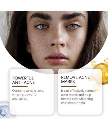 VKaoess Advanced AntiDark Spot Serum with Rollerball Supports Age and Sun Spots on Face and Body Cares for Uneven Tone and Dull Skin All Skin Types 5 Pack - Buy Online on GoSupps.com