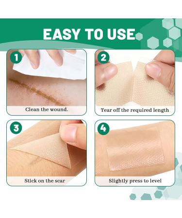 3 Rolls Silicone Scar Sheets(1.6" x 60" Each) Silicone Patches for Scars Reusable Scar Removal Strips for Prevention and Repair - Buy Online on GoSupps.com