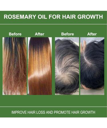 Buy 2 Pcs 100% Natural Rosemary Oil for Hair Growth & Scalp Care | Essential Oil for Healthy Hair | 60ml Green - Buy Online on GoSupps.com