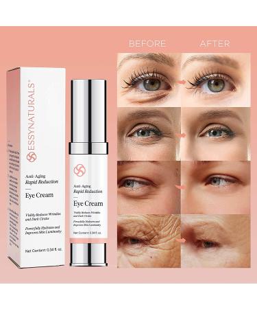 EssyNaturals Anti-Aging Rapid Reduction Eye Cream - Visibly Reduce Wrinkles, Under Eye Bags, Dark Circles & Fine Lines - Instant Results in 2 Minutes - Buy Online on GoSupps.com