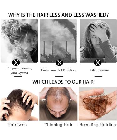 Ginger Shampoo Ginger Hair Regrowth Shampoo Anti Hair Loss Ginger Shampoo Natural Organic Ginger Shampoo Trophoblastic Hair Promote Hair Growth Smooth Anti Dandruff & Anti itching 200ML - Buy Online on GoSupps.com