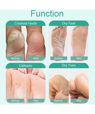 Mascarill Lot de 2 paires de chaussettes exfoliantes pour enlever les callosit s | Traitement de la peau morte et des talons fissur s | Hydratation profonde douceur b b spa maison - Buy Online on GoSupps.com