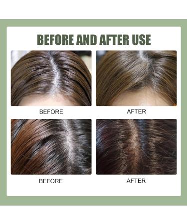  Pemarlis Sea Salt Shampoo Anti-Dandruff Shampoo Natural Shampoo for Oily Hair Deep Cleansing Moisturizing Care and Oil Control - Buy Online on GoSupps.com