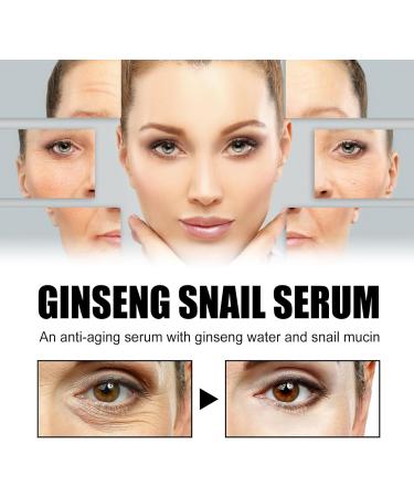 Repair Serum: Ginseng + Snail Mucin -Dark Spot Remover for Face - Niacinamide Serum for Improve the Water-oil Balance - Repair Damaged Skin for All Skin Types - Skin Care 30ml - Buy Online on GoSupps.com