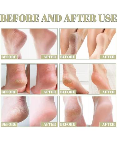 Honey Foot Cream Hand & Heel Cream for Very Dry Hands & Feet Foot Cream for Cracked Heels and Dry Skin Cracked Heel Repair Cream Foot Moisturiser Foot Care Products Cracked Heel Treatment Heel Cream - Buy Online on GoSupps.com