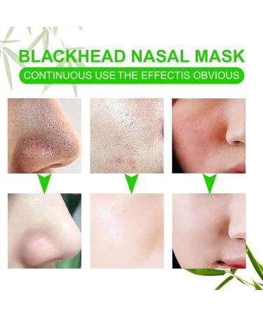 Dermatologist-Approved 80-Piece Charcoal Nose Strips for Blackhead Removal - Buy Online on GoSupps.com