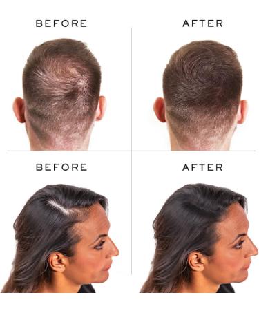 Nanogen Fibres 15g - Cinnamon - Pack of 1 - Buy Online on GoSupps.com