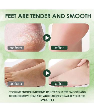 2 Paires Masque Pieds Peeling Exfoliant Les Masques Hydratants Pour Les Pied Crevasses Et Pieds Secs Hommes Et Femmes Rendre La Peau Plus Lisse(Alo S + Avocat) - Buy Online on GoSupps.com