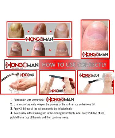 Hongosan Antifungal Original - As Seen on TV - Kit Completo for Nail Fungus, Yellow, Black, Dull, Brittle Nails - Buy Online on GoSupps.com