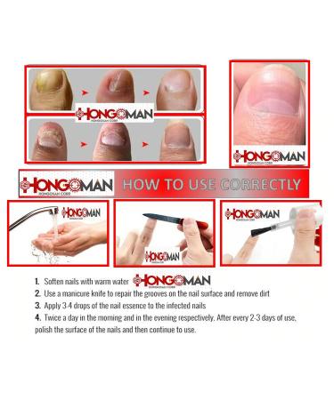 HONGOSAN Nail and Skin Treatment for Athlete's Foot, Rash, and Nail Fungus - Buy Online on GoSupps.com