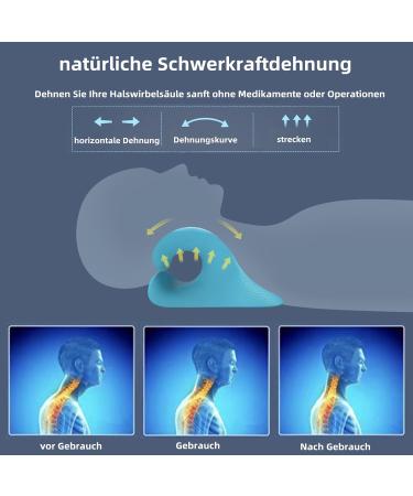 BEMKKG Neck Stretcher Orthopedic - Effective Neck & Shoulder Relaxer for Pain Relief | Cloudy Neck Cervical Traction Device - Shop Internationally! - Buy Online on GoSupps.com