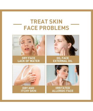 Natural Rice Face Toner Smoothing Toner for Face Facial Toner for Dry Essential Toner Deep Hydration Rice Face Toner Natural Moisturizer Glow Essence Rice Toner for Face Rice Toner - Buy Online on GoSupps.com