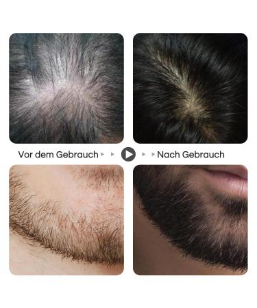 Dr.Roller Beard Serum - Stimulate Beard Growth | 30ml Men's Beard Oil for Thicker Hair - Buy Online on GoSupps.com