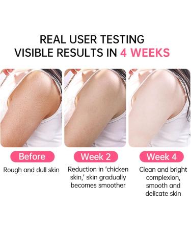 Skin Exfoliating Repair Cream Chicken Skin Care Cream Strawberry Legs Treatment Body Cream Hydrating Moisturising Refreshing Skin Fragrance Repair Body Lotion 50g - Buy Online on GoSupps.com
