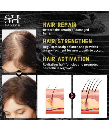 SEVICH Rice Water Hair Growth Spray with Olea Europaea Oil - 50ml | Natural Formula for Dry, Damaged Hair | Paraben-Free & Cruelty-Free - Buy Online on GoSupps.com