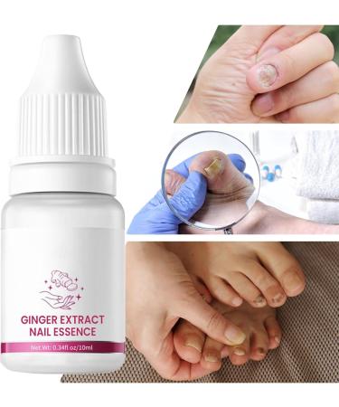  G n rique Nail Hardener Nails Nutrient Oil 10ml Natural Cuticle Oils Repair Softener Optimal Nail Revitalization for Foot Care Fingernails Yellow Toenail Ingrown Women and Men - Buy Online on GoSupps.com