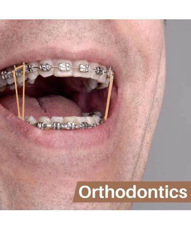 Buy 300 Medium Orthodontic Rubber Bands - Dental Elastics for Braces & Invisalign | Perfect for Orthodontist & Personal Use - Buy Online on GoSupps.com