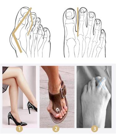 Bunion Corrector Pads - 2 Pair Gel Toe Separator & Cushion Protector for Big Toe Hammer Toe Straightener and Bunion Relief - Foot Pain Relief and Callus Corns Prevention - Buy Online on GoSupps.com