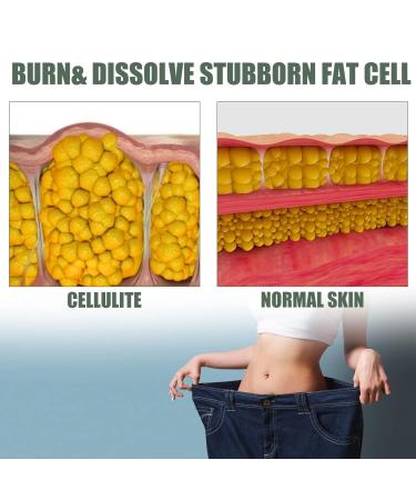 Wormwood Fat Burning Cream - Slimming Gel for Weight Loss Cellulite Reduction & Skin Firming (30g) | Soothing Relaxing Tightening Formula | International Shipping Available - Buy Online on GoSupps.com