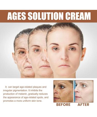 Buy Ages Solution Cream - Anti-Aging Dark Spot Remover Even Skin Tone Hydration & Elasticity - 20g - Buy Online on GoSupps.com