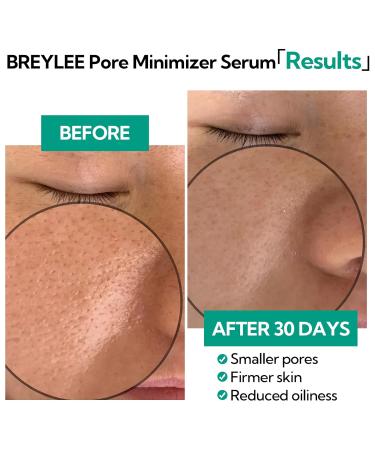 BREYLEE Pore Minimizer Serum - Refine & Tighten Pores Control Oil Soothing Skin Care for Face & Nose - Buy Online on GoSupps.com