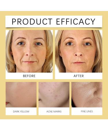 Clawrex Organic beef tallow cream Beef Tallow cream for body and face natural Beef Tallow Skincare with honey beeswax deep hydration skin hipped tallow balm tallow face cream for - Buy Online on GoSupps.com