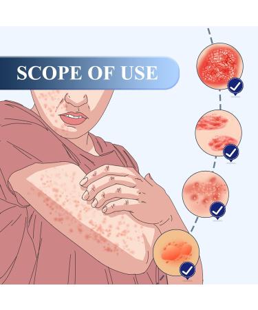 BOSSIK 2023 Eczema Therapy Spray - Fast Acting Relief for Dry, Itchy Skin (5pcs) - Buy Online on GoSupps.com