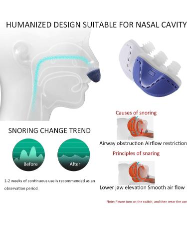 Cindiat Electric Anti-Snoring Device with Silicone Fixation Belt - Stop Snoring Solution for Men and Women (Blue) - Buy Online on GoSupps.com