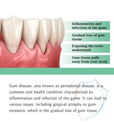 Dentizen Gouttes de repousse des gencives traitement de repousse des gencives restauration naturelle des gencives avec gouttes liquides bain de bouche repousse des gencives (1 pi ce) 1 Pi ce. - Buy Online on GoSupps.com