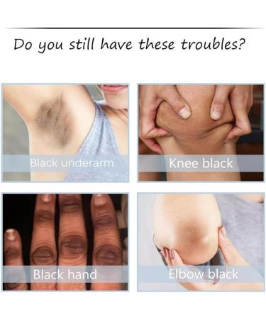 Cr me claircissante pour les aisselles claircit et hydrate formule douce sans agent blanchissant pour les aisselles les coudes et les genoux. 1PC - Buy Online on GoSupps.com