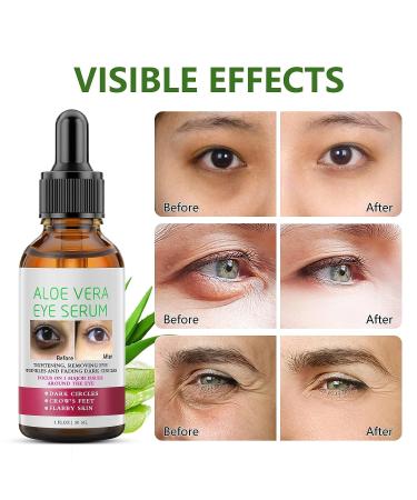 Aloe Vera Anti Aging Eye Serum | Dark Circle & Puffiness Treatment for Women - Buy Online on GoSupps.com