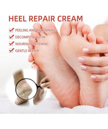 Urea 40% Foot Cream Foot Cream for Cracked Heels and Dry Skin Moisturizing Cracked Heel Repair Cream for Feet and Hand Cracked Heel Repair Cream Foot Moisturiser Urea Cream Heel Balm for Cracked Heel - Buy Online on GoSupps.com