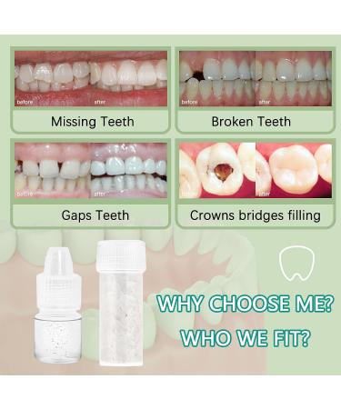 Teeth Repair Kit - Fill Missing/Broken Tooth, Close Gaps, Quick & Safe Temporary Fix | Regain Confidence in Smile - Buy Online on GoSupps.com