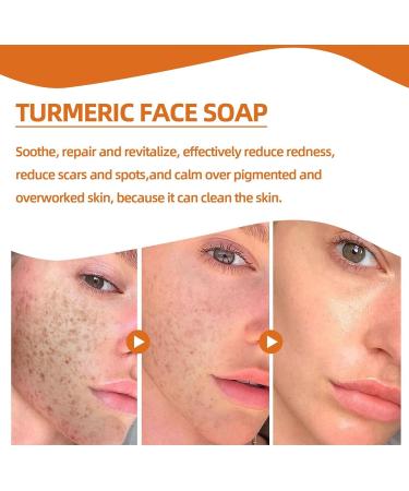Turmeric Soap | Skin Lightening Kojic Acid Soap | Soap Bars for Hyperpigmentation Acne Spot Removal - Buy Online on GoSupps.com