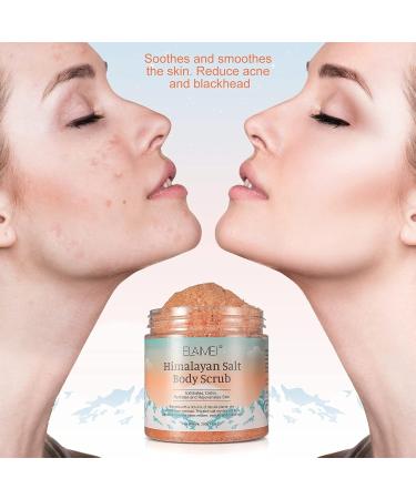 Himalayan Salt Body Sugar Scrub - Exfoliating Hand & Face Cleanser for Acne Dead Skin Removal | Moisturizing Bump Eraser Scrub 8.8 oz - Buy Online on GoSupps.com