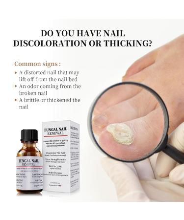 Extra Strength Toenail Fungus Treatment - Fast Acting Nail Repair Liquid for Discolored Nails with Nail File - Buy Online on GoSupps.com