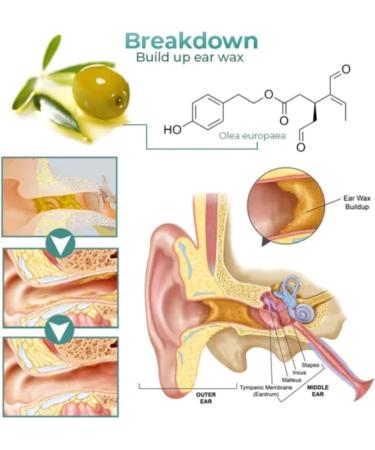 Earwax Removal Spray 30ml - Natural Solution for Cochlear Blockage & Clogged Ears - Swimmer's Ear Relief - 1pc - Buy Online on GoSupps.com
