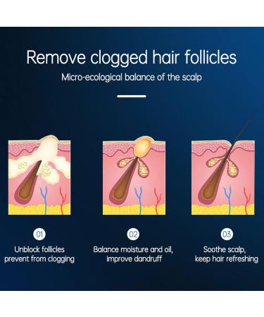 Itchy Scalp Spray Hair Moisturizing Spray Dry Scalp Treat With Nozzle Design To Adjust Water And Oil Balance Suitable For Most Kinds Of Hair Including Oil Hair - Buy Online on GoSupps.com