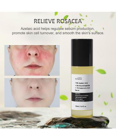 Azelaic Acid 10% Serum - Reduces Facial Redness | 3.4 fl. oz. (100ml) - Best Azelaic Acid Serum for Face | International Shipping Available - Buy Online on GoSupps.com