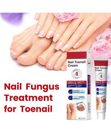 Fungal Nail Treatment Cream Antifungal Nail Polish Cream Nail Fungus Treatment for Toenail Strong Anti-Fungal Toenail Cream Nail Improve Cream Nail Repair Cream for Thick Cracked Discolored Nails - Buy Online on GoSupps.com