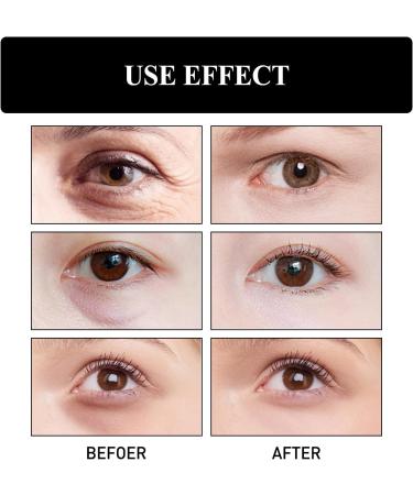 YOENBG Set of 3 anti-wrinkle eye creams - Anti-wrinkle eye cream - Restores elasticity to the skin around the eyes - Reduces puffiness and dark circles - Buy Online on GoSupps.com