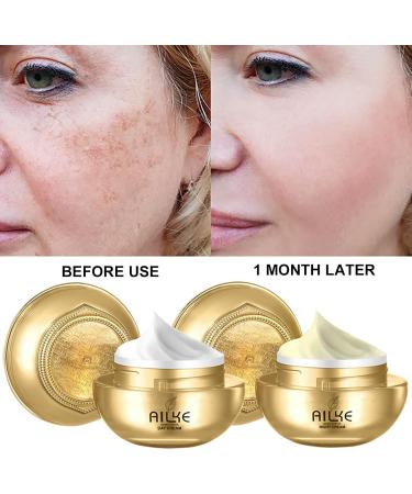  AILKE BOOST LUSTER Premium Collagen Whitening Cream Anti Dark Spot Freckle Anti Wrinkle 5 in 1 Kit with Facial Cleanser Toner Serum Day & Night Cream - Buy Online on GoSupps.com