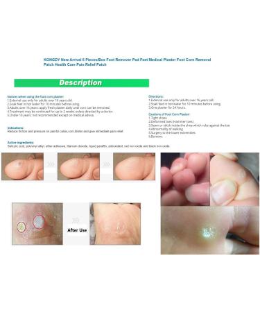 KONGDY Foot Corn Remover Patch - Pain Relief Toe Medical Plaster for Foot Corn Removal - Buy Online on GoSupps.com