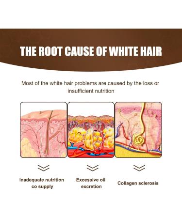 Reverse Gray Hair Natural Nourishing Hair Growth Essence Volumizing Anti Gray Hair Essence 30ml Men Women Hair Care for Shiny Healthy Black Hair Eastuy - Buy Online on GoSupps.com