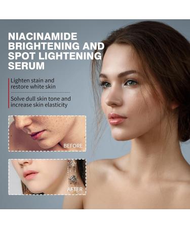 Niacinamide Serum Brightening Serum Dark Spot Remover for Face Face Serum for Dry Skin Age Spot Remover For Face Face Redness Remover Fades Dark Spot Boost Skin Collagen Hydrate & Brighten - Buy Online on GoSupps.com